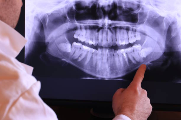 Best Emergency Dental Services for Seniors in Santa Anna, TX