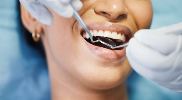 Best Emergency Root Canal Treatment in Santa Anna, TX
