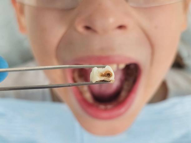 Best Emergency Dentist for Special Needs Patients in Santa Anna, TX